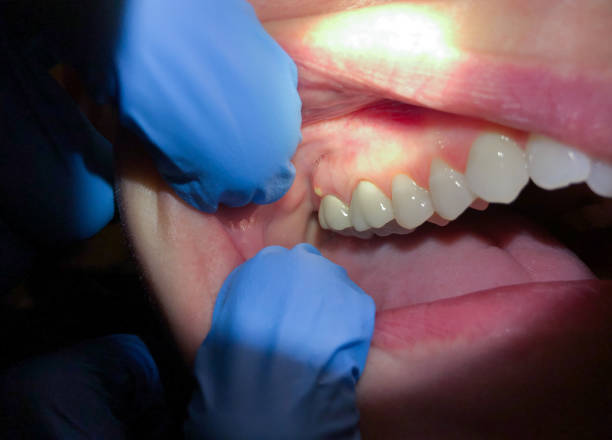 Best Cracked Tooth Emergency Dentist  in Ludlow, KY